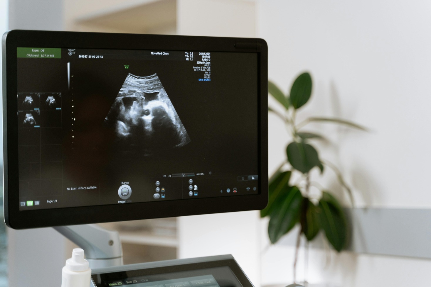 Obstetrics And Gynecology Ultrasound