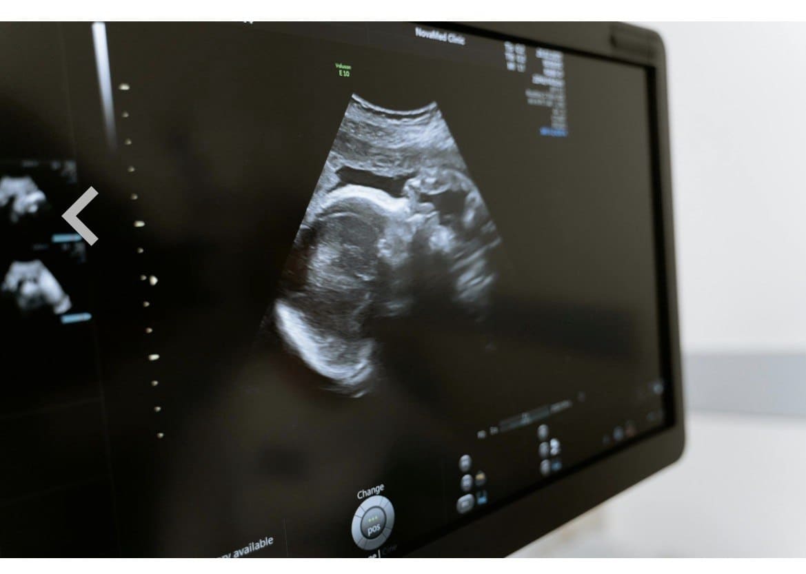 Obstetrics and Gynecology Ultrasound